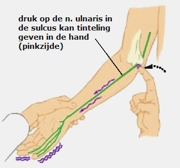 studio Strak Integreren Cubitaal tunnelsyndroom - Golfarm